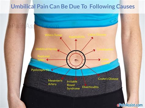 Abdominal Pain Chart And Symptoms