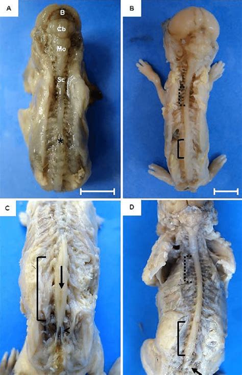 Fetal development of the central nervous system of guinea pigs. (A)... | Download Scientific Diagram