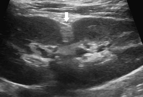 13 Kidneys | Radiology Key