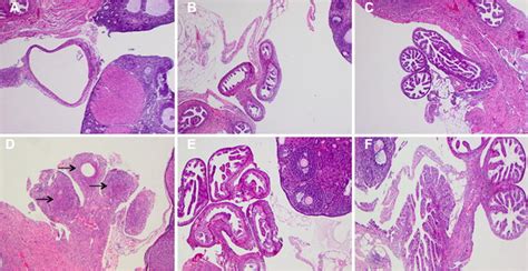 Oviduct histology after challenge infection. Mice were challenged with... | Download Scientific ...