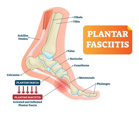 Foot Anatomy Plantar Fascia - Abba Humananatomy