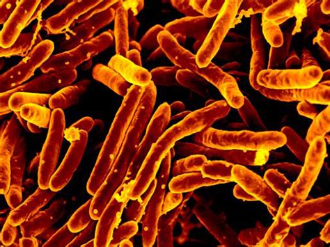 Tuberculosis kills thousands of people every day - Business Insider