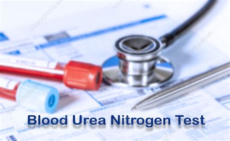 Blood urea nitrogen test, conceptual image - Stock Image - F037/1124 ...