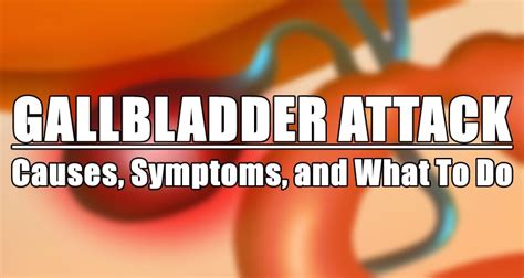 Gallbladder Attack: Causes, Symptoms, and What To Do