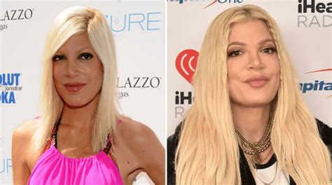 Tori Spelling Plastic Surgery Transformation | PlasticSurgeryInsights.com