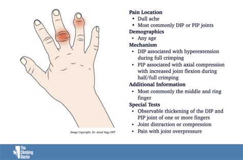 Capsulitis and Synovitis Climbing - Swelling of the Fingers - The Climbing Doctor