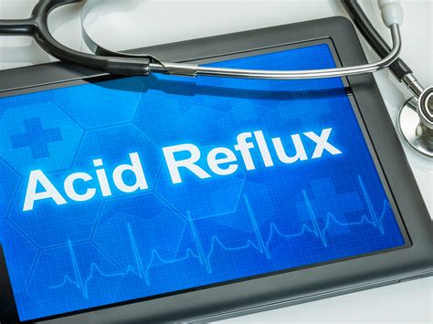 4 acid reflux remedies that won’t give you a stroke - Easy Health Options®