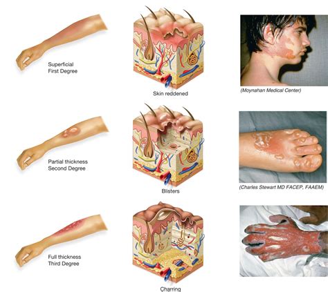 Pin on Chapter 6: The Integumentary System