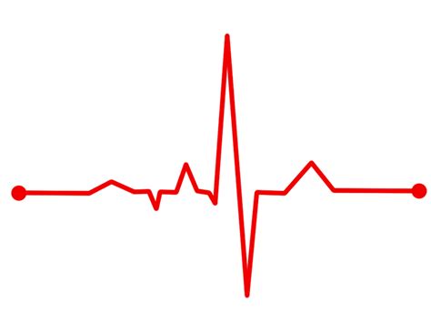 Medicina General Universal: Que es un electrocardiograma