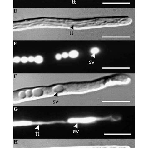 Fluorescence and corresponding DIC images of hyphae labelled with ...