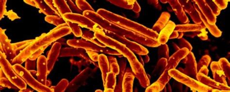 Arrest Warrant Issued For US Woman Who Refused Tuberculosis Treatment : ScienceAlert