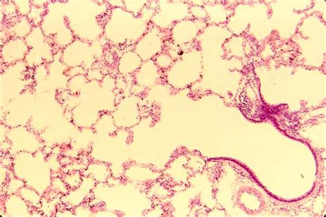 Terminal Bronchiole Histology