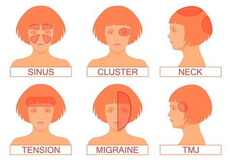 Pin by Liz Butler on Migraine relief in 2020 | Headache types, Headache ...