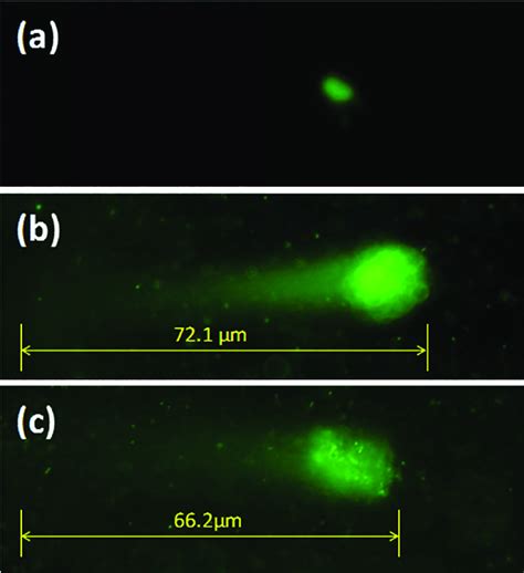 Comet assay images of bacteria after different treatments: control (a ...