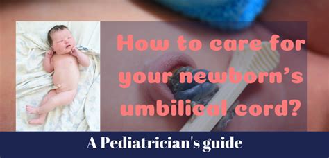 How to care for your newborn's Umbilical Cord? - the mom centre