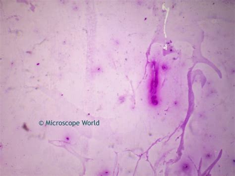 Microscope World Blog: Tuberculosis Viewed Under the Microscope