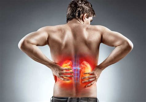 18 Warning Signs of Kidney Infection You Should Not Ignore