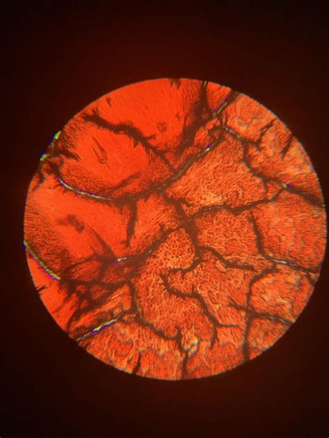 Dried blood under microscope at different zooms. Branch like pattern explained in comments (NOT ...