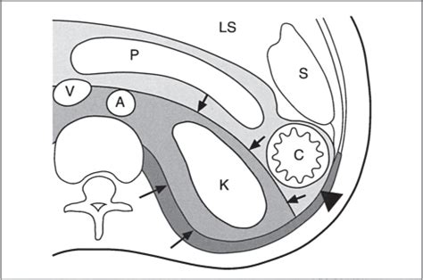 27 Kidneys | Radiology Key