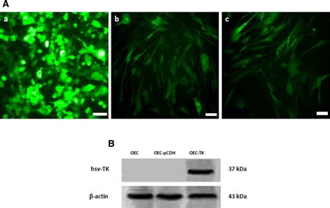 Lentiviral transfection and transduction efficiency in HEK-293 cells ...