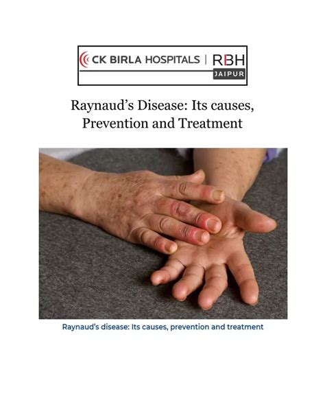 PPT - Raynaud’s disease: Its causes, prevention and treatment PowerPoint Presentation - ID:10978816