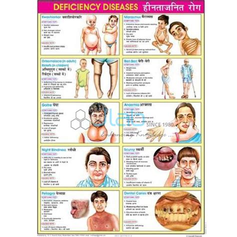 Deficiency Diseases Chart India, Manufacturers, Suppliers & Exporters in India