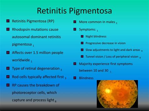 PPT - Rhodopsin PowerPoint Presentation, free download - ID:1871143