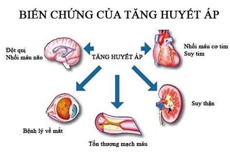 Tư vấn dành cho người bệnh cao huyết áp | Trạm Y tế Phường Phú Hữu