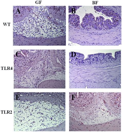 Macrophage Staining