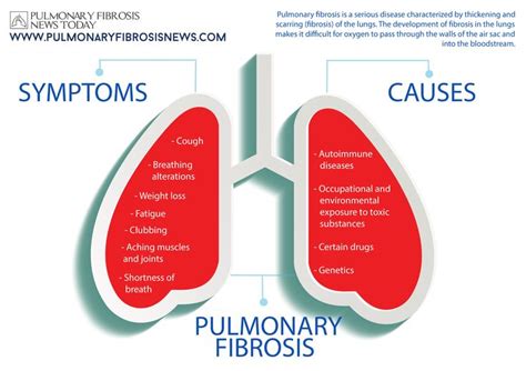 4 Common Coughing Triggers for Idiopathic Pulmonary Fibrosis | Idiopathic pulmonary fibrosis ...