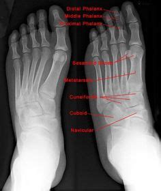 anatomy musculoskeletal x ray - Căutare Google | Sănătate în 2018 | Pinterest | Radiology ...