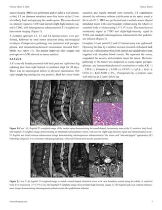 Cauda Equina Neuroendocrine Tumor: Report of Two Cases and Review of Literature | PDF