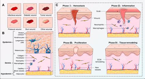 Wound types, skin structure, and wound healing phases. a Different... | Download Scientific Diagram