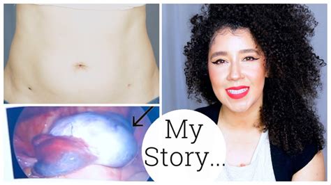 I'm Back! | My Ovarian Cyst Story | Ovarian Torsion | Laparoscopy Surgery - YouTube