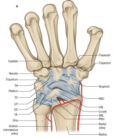 Lunate Dislocation (Perilunate dissociation) - Hand - Orthobullets