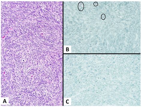 Diagnostics | Free Full-Text | Immunohistochemistry for Claudin-4 and ...