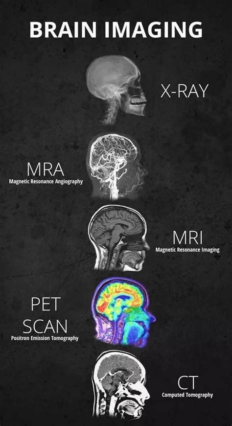 Different brain "scan" methods - 9GAG