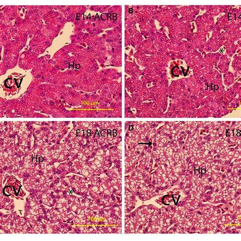 | Gene expression in the liver of ACRB and Cobb broilers on E14 and ...