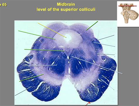 Midbrain - superior colliculi level Diagram | Quizlet