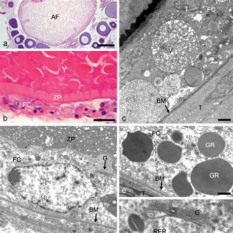 (PDF) Ovarian follicular atresia is mediated by heterophagy, autophagy, and apoptosis in ...