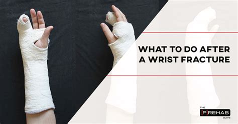 What To Do After A Wrist Fracture With Exercises | [𝗣]𝗥𝗲𝗵𝗮𝗯