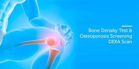 Bone Density Test & Osteoporosis Screening- DEXA Scan – Blog | Trivitron Healthcare Solutions ...