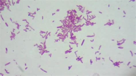 escherichia coli bakterien e unter mikroskop: Stockvideos & Filmmaterial (100 % lizenzfrei ...