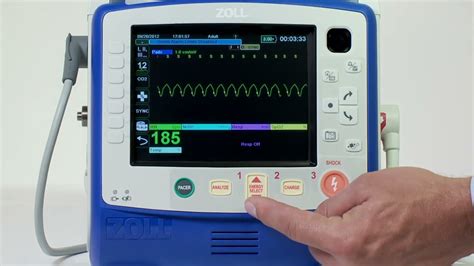 X Series®: Synchronized Cardioversion (English) - YouTube