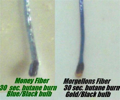 Comparative Study of Morgellons Fibers With The Colored Fibers Found of ...