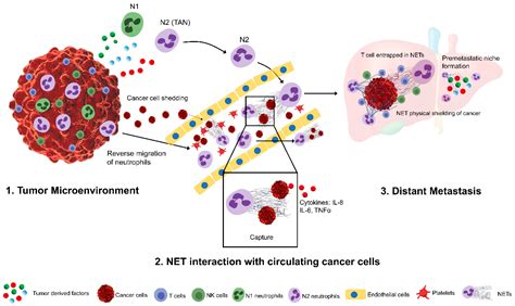 Neutrophil Extracellular Traps (NETs) in Cancer Metastasis