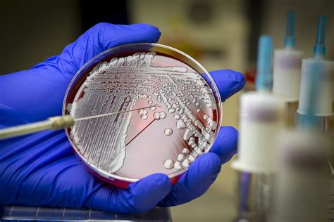 Superbugs are Killing People Every 15 Minutes - BlackDoctor.org - Where ...