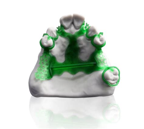UnionTech Dental 3D Printing Digital Solutions - 3D Printing