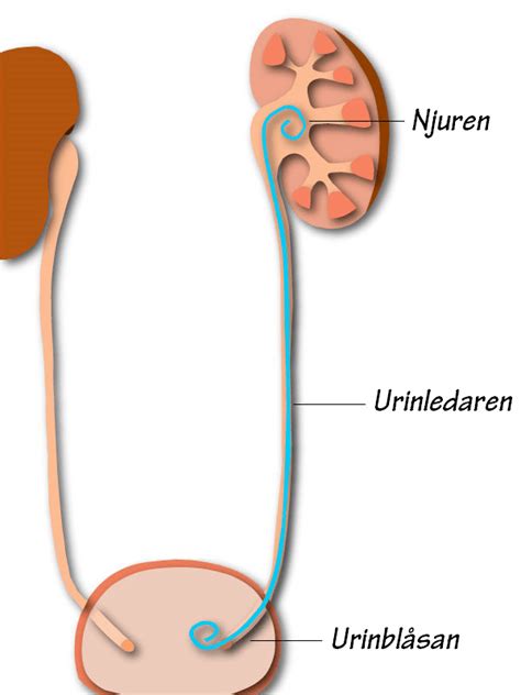 V.13- inlagd, stent, feber och smärta – Yasmin Shamsudin