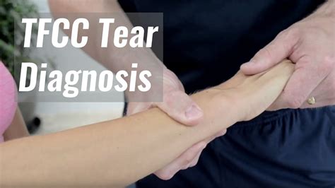 TFCC Compression Test Triangular Fibrocartilage Complex, 57% OFF